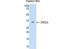 Detection of Recombinant LEFTY1, Human using Polyclonal Antibody to Left/Right Determination Factor 1 (LEFTY1) (LEFTY1 抗体  (AA 78-361))