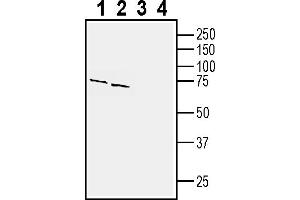 Western blot analysis of mouse brain membranes (lanes 1 and 3) and rat brain lysates (lanes 2 and 4):1-2. (GPR143 抗体  (Intracellular))