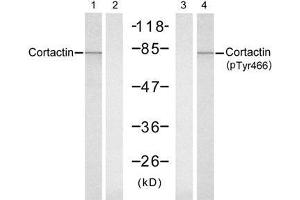 Western blot analysis of extracts from Hela cells, untreated or treated with UV (20min), using Cortactin (Ab-466) antibody (E021264, Lane 1 and 2) and Cortactin (Phospho-Tyr466) antibody (E011272, Lane 3 and 4). (Cortactin 抗体)
