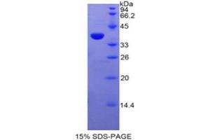 SDS-PAGE (SDS) image for Fibulin 4 (FBLN4) (AA 136-225) protein (His tag,GST tag) (ABIN1878176)