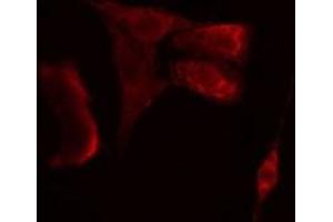 ABIN6275709 staining  A549 cells by IF/ICC. (RAD23B 抗体  (N-Term))