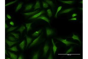 Immunofluorescence of monoclonal antibody to CCBL1 on HeLa cell. (CCBL1 抗体  (AA 1-374))