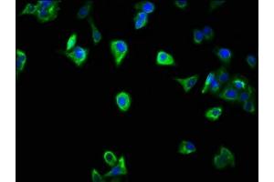 Immunofluorescence staining of HepG2 cells with ABIN7169521 at 1:266, counter-stained with DAPI. (SCOC 抗体  (AA 1-121))