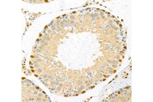 Immunohistochemistry of paraffin embedded rat testis using CUX2 (ABIN7073607) at dilution of 1:700 (300x lens) (CUX2 抗体)