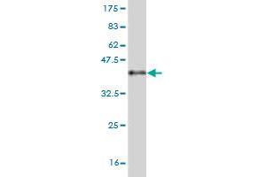 Western Blot detection against Immunogen (37. (Pleiotrophin 抗体  (AA 45-154))