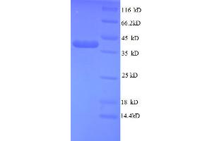 SDS-PAGE (SDS) image for Teratocarcinoma-Derived Growth Factor 1 (TDGF1) (AA 32-150), (partial) protein (GST tag) (ABIN5712754) (TDGF1 Protein (AA 32-150, partial) (GST tag))