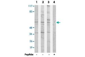 Western blot analysis of extracts from 293 cells (Lane 1), HepG2 cells (Lane 2) and Jurkat cells (Lane 3 and lane 4), using ACRBP polyclonal antibody . (ACRBP 抗体)