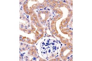 Paraformaldehyde-fixed, paraffin embedded mouse kidney tissue, Antigen retrieval by boiling in sodium citrate buffer (pH6. (RPS6 抗体)