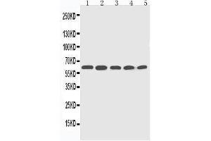 Anti-CYP2U1 antibody, Western blotting Lane 1: HELA Cell Lysate Lane 2: MCF-7 Cell Lysate Lane 3: MM453 Cell Lysate Lane 4: COLO320 Cell Lysate Lane 5:  Cell Lysate (CYP2U1 抗体  (C-Term))
