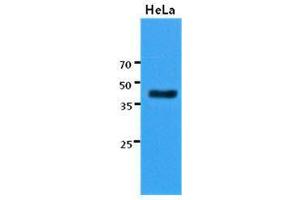 The cell lysates of HeLa (30 ug) were resolved by SDS-PAGE, transferred to PVDF membrane and probed with KRT23 antibody (1:3000). (KRT23 抗体  (AA 271-422))