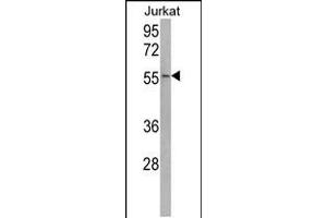 Western blot analysis of USP22 Antibody in Jurkat cell line lysates (35ug/lane) (USP22 抗体  (C-Term))