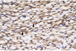 Rabbit Anti-CCL7 Antibody  Paraffin Embedded Tissue: Human Heart Cellular Data: Myocardial cells Antibody Concentration: 4. (CCL7 抗体  (N-Term))