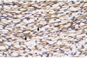 Rabbit Anti-CCL7 Antibody  Paraffin Embedded Tissue: Human Heart Cellular Data: Myocardial cells Antibody Concentration: 4.