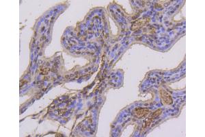 Paraformaldehyde-fixed, paraffin embedded mouse placenta, Antigen retrieval by boiling in sodium citrate buffer (pH6) for 15min, Block endogenous peroxidase by 3% hydrogen peroxide for 30 minutes, Blocking buffer at 37°C for 20min, Antibody incubation with Estrogen Receptor alpha(Ser118) (3A7) Monoclonal Antibody  at 1:50 overnight at 4°C, followed by a conjugated secondary and DAB staining. (Estrogen Receptor alpha 抗体  (pSer118))