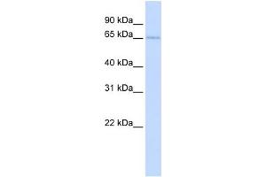 WB Suggested Anti-TKTL2 Antibody Titration:  0. (TKTL2 抗体  (N-Term))