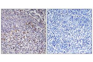 Immunohistochemistry analysis of paraffin-embedded human tonsil tissue using Cytochrome c-type Heme Lyase antibody. (HCCS 抗体  (Internal Region))