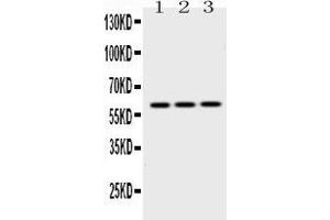 Western blot analysis of Cytokeratin 14 expression in rat brain extract ( Lane 1), NIH3T3 whole cell lysates ( Lane 2) and HEPG2 whole cell lysates ( Lane 3). (KRT14 抗体  (C-Term))