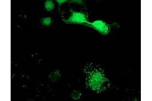 Image no. 12 for anti-Sepiapterin Reductase (SPR) antibody (ABIN1501111)
