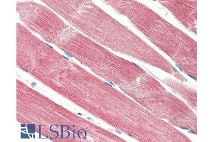 ABIN5539898 (5µg/ml) staining of paraffin embedded Human Skeletal Muscle. (THNSL2 抗体  (Internal Region))