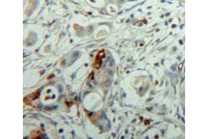 Used in DAB staining on fromalin fixed paraffin-embedded pancreas tissue (NEU1 抗体  (AA 141-286))