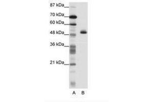 Image no. 1 for anti-Zinc Finger Protein 213 (ZNF213) (N-Term) antibody (ABIN202568) (ZNF213 抗体  (N-Term))