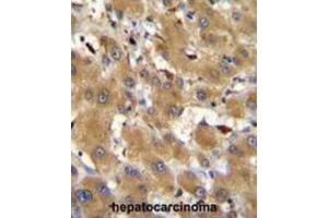 Immunohistochemistry (IHC) image for anti-Haptoglobin Related Protein (HPR) antibody (ABIN2996022) (HPR 抗体)