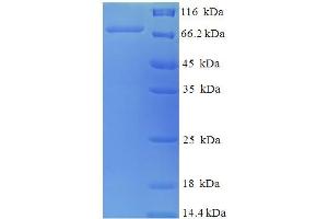 SDS-PAGE (SDS) image for Protein Disulfide Isomerase Family A, Member 2 (PDIA2) (AA 21-527) protein (His-SUMO Tag) (ABIN5710081) (PDIA2 Protein (AA 21-527) (His-SUMO Tag))