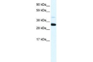 WB Suggested Anti-ANXA3 Antibody Titration:  1. (Annexin A3 抗体  (N-Term))