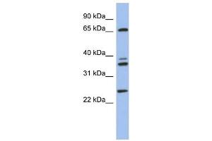 Western Blotting (WB) image for anti-ATPase, H+ Transporting, Lysosomal 70kDa, V1 Subunit A (ATP6V1A) (N-Term) antibody (ABIN631586)