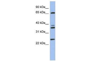 ATP6V1A antibody used at 1 ug/ml to detect target protein. (ATP6V1A 抗体  (N-Term))