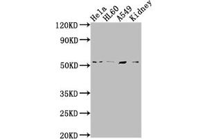 Western Blot Positive WB detected in: Hela whole cell lysate, HL60 whole cell lysate, A549 whole cell lysate, Mouse kidney tissue All lanes: ILK antibody at 1:2000 Secondary Goat polyclonal to rabbit IgG at 1/50000 dilution Predicted band size: 52, 45, 37 kDa Observed band size: 51 kDa (Recombinant ILK 抗体)