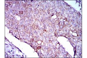 Immunohistochemistry (IHC) image for anti-Lipoprotein (Lp(a)) (AA 4330-4521) antibody (ABIN1845714) (Lp(a) 抗体  (AA 4330-4521))