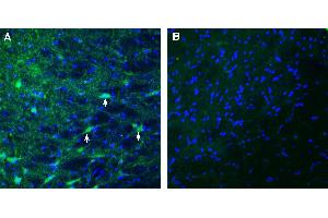 anti-Multiple EGF-Like-Domains 10 (MEGF10) (AA 178-190), (Extracellular) antibody