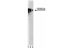 Western blot analysis of Ataxin-2 on Jurkat cell lysate (left). (Ataxin 2 抗体  (AA 713-904))