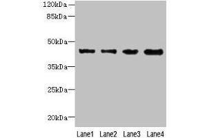 Western blot All lanes: KCTD9 antibody at 8 μg/mL Lane 1: MCF-7 whole cell lysate Lane 2: HepG2 whole cell lysate Lane 3: HT29 whole cell lysate Lane 4: U251 whole cell lysate Secondary Goat polyclonal to rabbit IgG at 1/10000 dilution Predicted band size: 43 kDa Observed band size: 43 kDa (KCTD9 抗体  (AA 1-200))