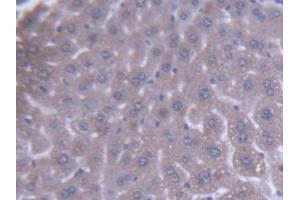 IHC-P analysis of Mouse Liver Tissue, with DAB staining. (ACAA1 抗体  (AA 182-424))