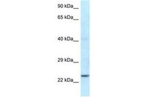 Image no. 1 for anti-Ring Finger Protein 141 (RNF141) (N-Term) antibody (ABIN6747518) (RNF141 抗体  (N-Term))