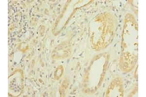 Immunohistochemistry (IHC) image for anti-Carboxymethylenebutenolidase Homolog (CMBL) (AA 2-245) antibody (ABIN7146755)