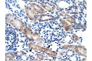 CLIC1 antibody was used for immunohistochemistry at a concentration of 4-8 ug/ml to stain Epithelial cells of renal tubule (arrows) in Human Kidney. (CLIC1 抗体  (N-Term))
