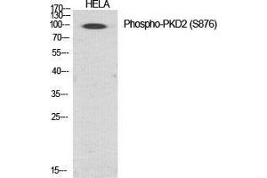 Western Blot (WB) analysis of specific cells using Phospho-PKD2 (S876) Polyclonal Antibody. (PKD2 抗体  (pSer876))