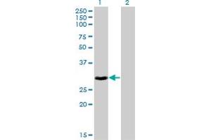 Western Blot analysis of HOXB9 expression in transfected 293T cell line by HOXB9 monoclonal antibody (M10), clone 2F8.