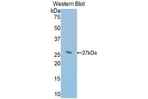Western Blotting (WB) image for anti-Interleukin 2 Receptor, beta (IL2RB) (AA 27-240) antibody (ABIN1859416) (IL2 Receptor beta 抗体  (AA 27-240))