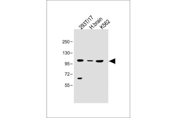 Solute Carrier Family 14 (Urea Transporter, Kidney) Member 2 (SLC14A2) (AA 42-76) 抗体