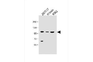 All lanes : Anti-SLC14A2 Antibody (N-Term) at 1:500 dilution Lane 1: 293T/17 whole cell lysate Lane 2: Human brain lysate Lane 3: K562 whole cell lysate 293T/17 whole cell lysate at 30 μg per lane. (Solute Carrier Family 14 (Urea Transporter, Kidney) Member 2 (SLC14A2) (AA 42-76) 抗体)