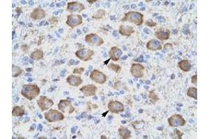 Immunohistochemical staining (Formalin-fixed paraffin-embedded sections) of human brain with TNFRSF18 polyclonal antibody  at 4-8 ug/mL working concentration. (TNFRSF18 抗体  (C-Term))