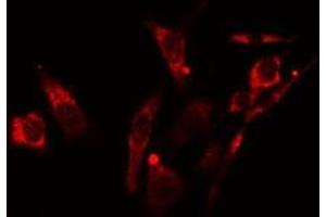 ABIN6278264 staining NIH-3T3  cells by IF/ICC.