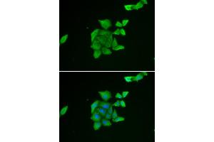 Immunofluorescence analysis of U2OS cell using TUSC2 antibody. (TUSC2 抗体)