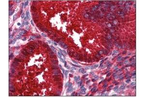 Immunohistochemistry (IHC) image for anti-Serpin Peptidase Inhibitor, Clade G (C1 Inhibitor), Member 1 (SERPING1) (AA 1-501) antibody (ABIN782340)