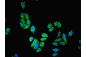Immunofluorescent analysis of HepG2 cells using ABIN7163080 at dilution of 1:100 and Alexa Fluor 488-congugated AffiniPure Goat Anti-Rabbit IgG(H+L) (Phenylalanine Hydroxylase 抗体  (AA 2-452))