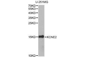 Western blot analysis of extracts of U-251MG cells, using KCNE2 antibody. (KCNE2 抗体)
